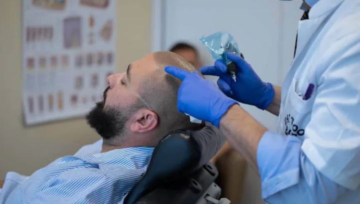 microhaarpigmentatie-wat-is-micro-haar-pigmentatie-5