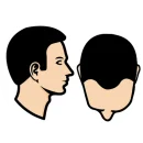 Kleine inham + haarlijn