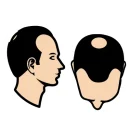 Kleine kruin + kleine inham